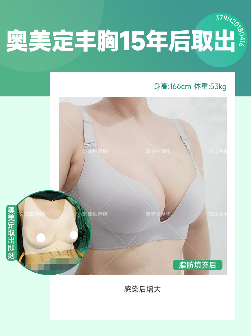 如何识别丰体针丰胸后的过敏症状及应对方法